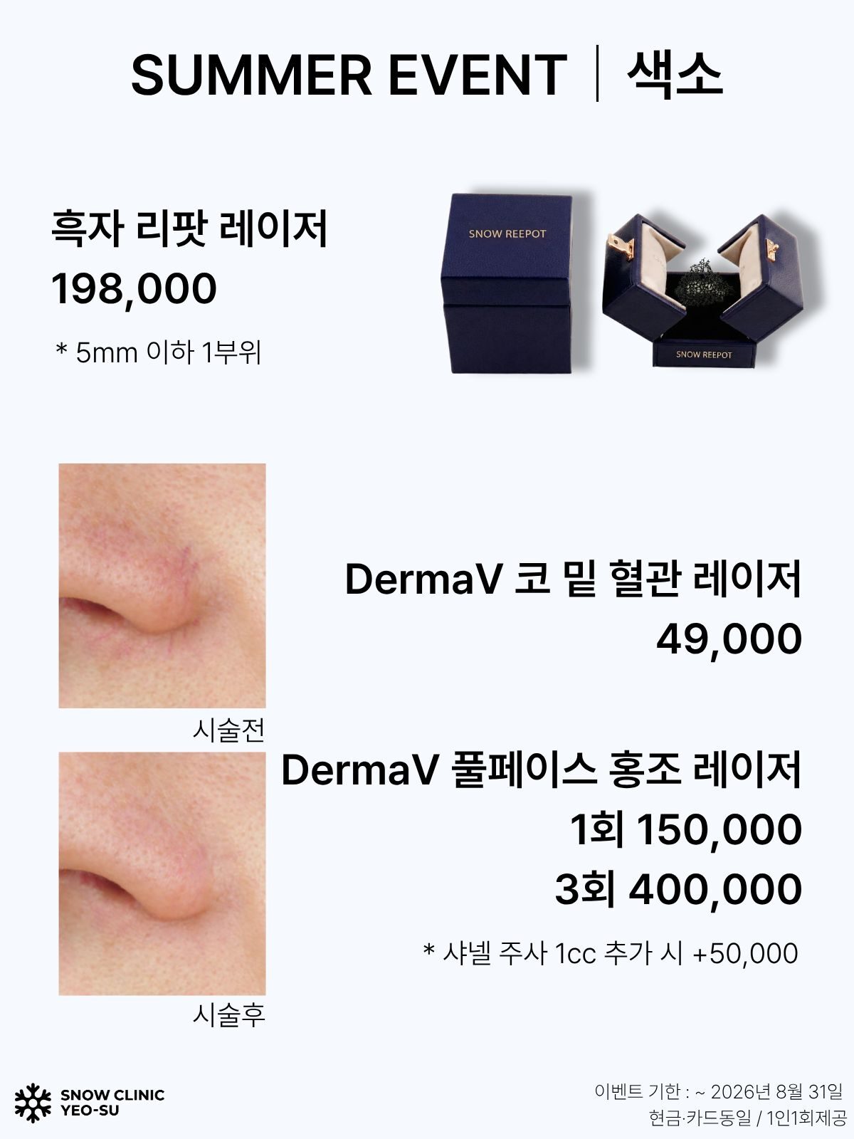 기미/흑자 EVENT
