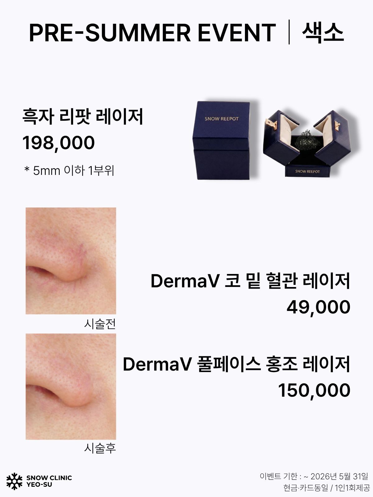 기미/흑자 EVENT